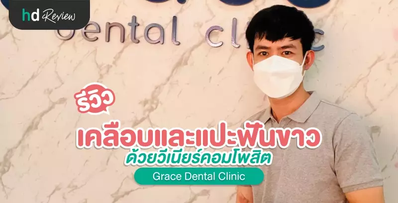 รีวิว ทำวีเนียร์ แปะฟันขาว ด้วยวีเนียร์คอมโพสิต ที่ Grace Dental Clinic