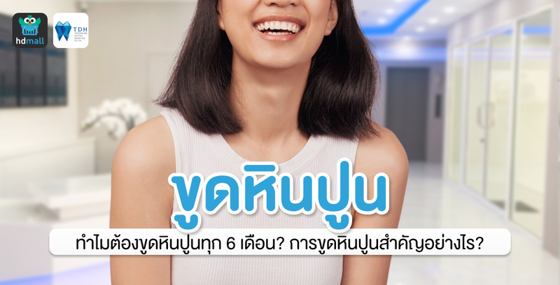 ทำไมต้องขูดหินปูนทุก 6 เดือน? การขูดหินปูนสำคัญอย่างไร? ตอบคำถามโดยทันตแพทย์จาก TDH