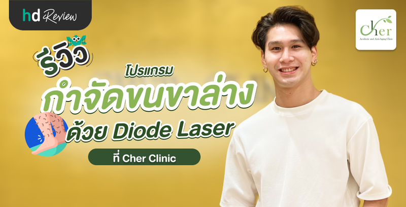 รีวิวโปรแกรมกำจัดขนขาล่าง ด้วย Diode Laser ที่ Cher Clinic