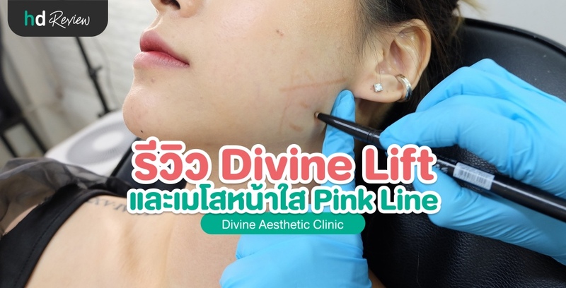 รีวิว Divine Lift ลิฟท์กรอบหน้า และเมโสหน้าใส Pink Line ที่ Divine Aesthetica Clinic