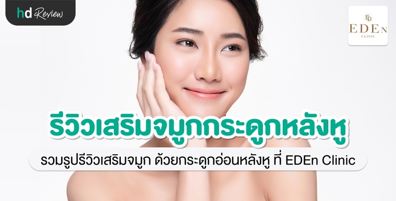 รีวิว เสริมจมูกกระดูกอ่อนหลังหู ที่ E-Den Clinic