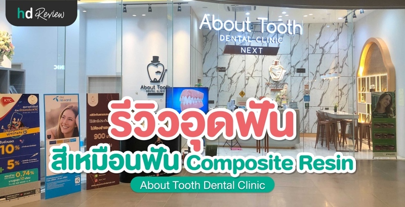รีวิว อุดฟัน สีเหมือนฟัน ที่ About Tooth Dental Clinic