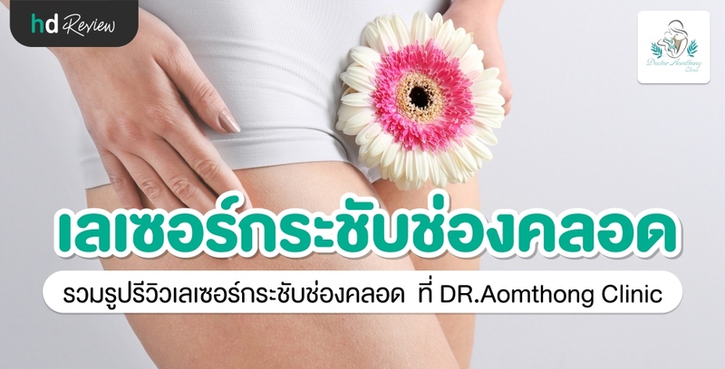 รีวิว กระชับช่องคลอดด้วยเครื่อง Exilis Ultra Femme 360 องศา ที่ Dr. Aomthong Clinic