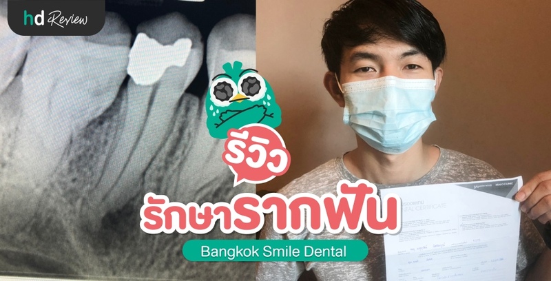รีวิวรักษารากฟัน ที่ Bangkok Smile Dental