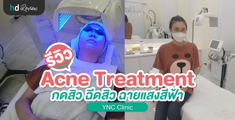 รีวิว Acne Treatment กดสิว ฉีดสิว ฉายแสง ที่ YNC Clinic